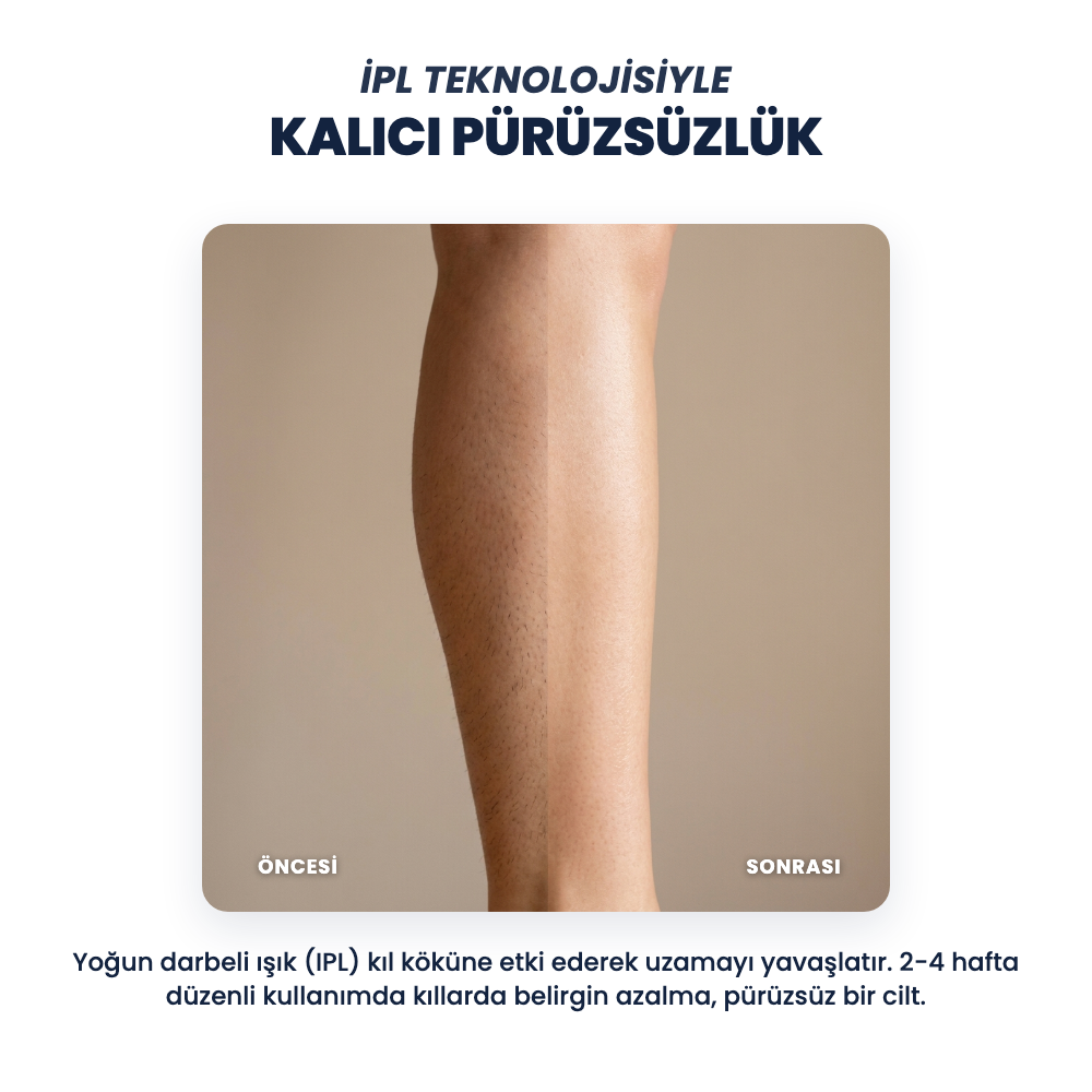 IPL teknolojisi, kalıcı pürüzsüzlük, öncesi sonrası